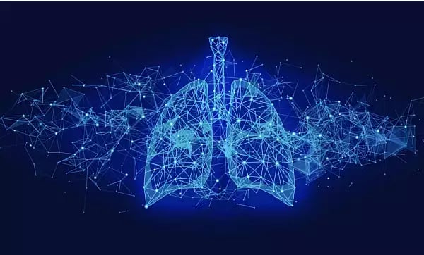 Air Apprehensions: Rethinking Milieu in Epidemic Media 1