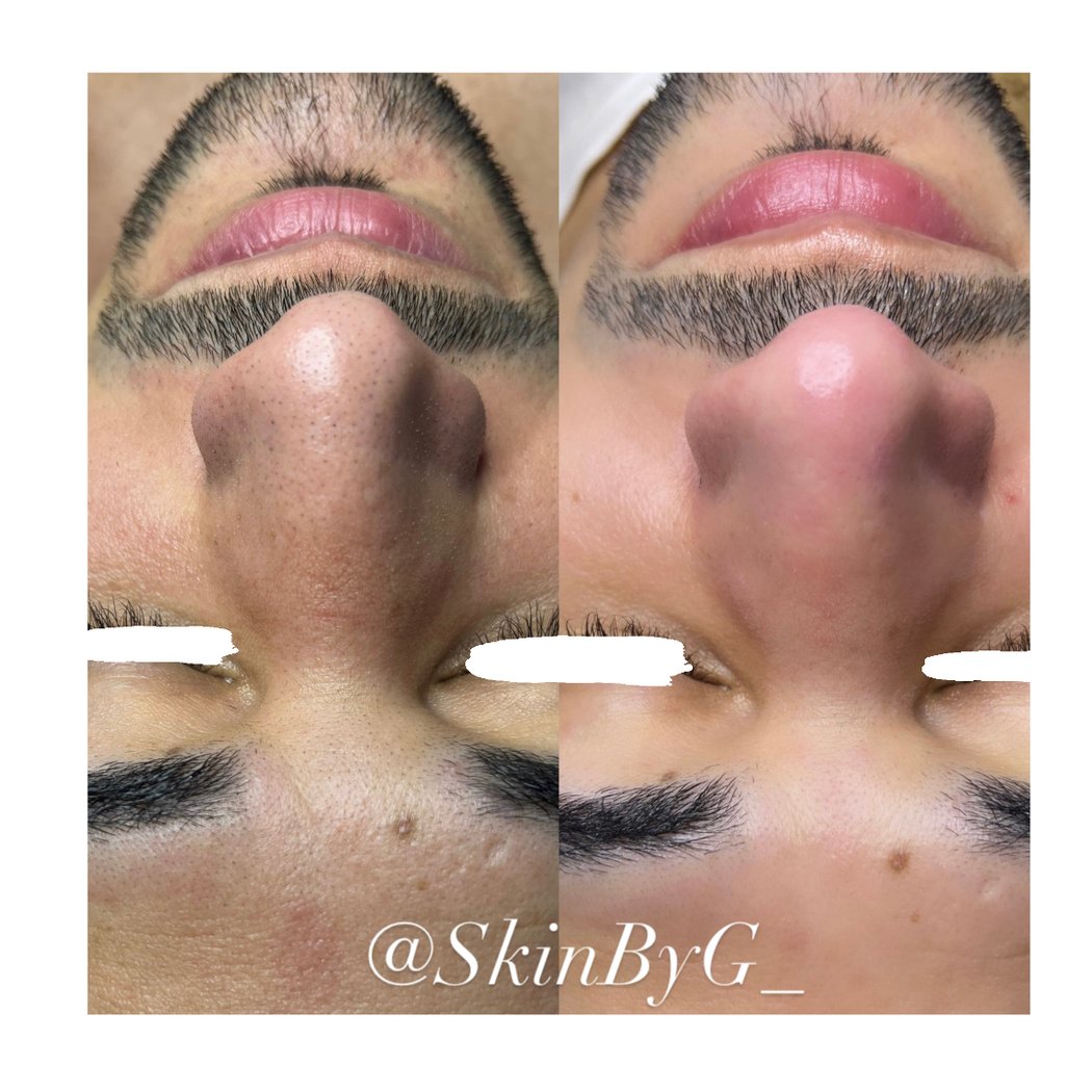 Skin By G 3