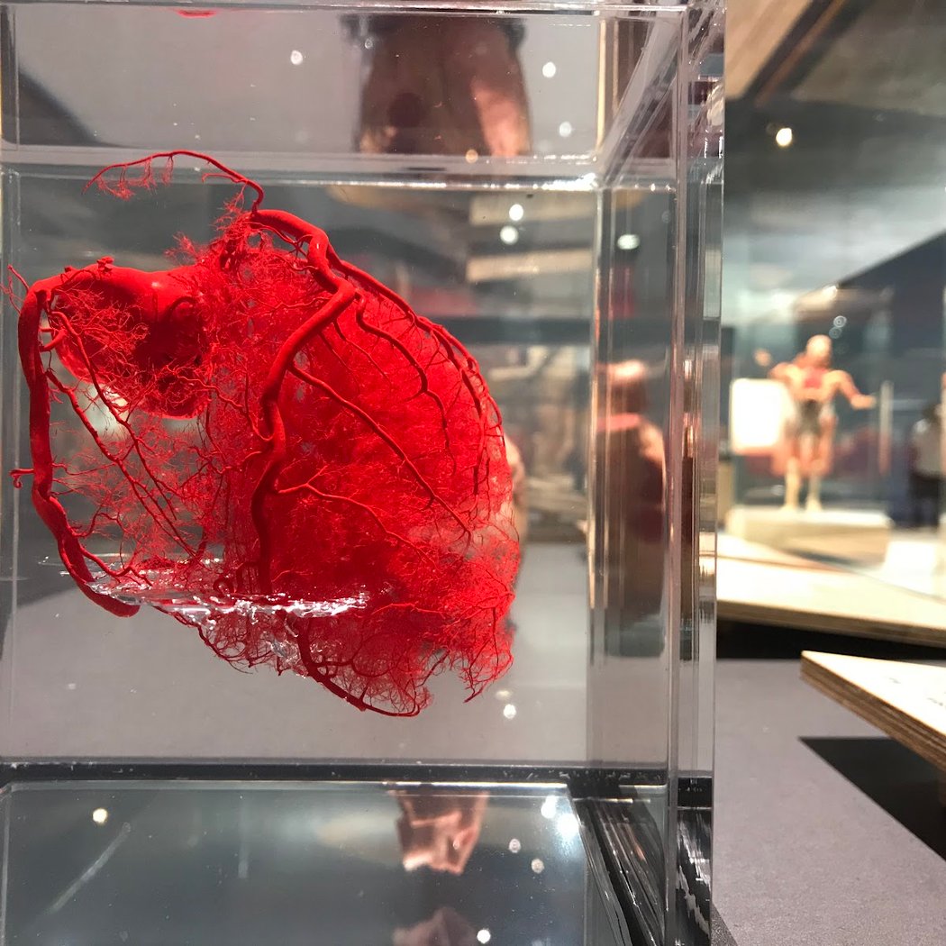 BODY WORLDS Exhibit 1