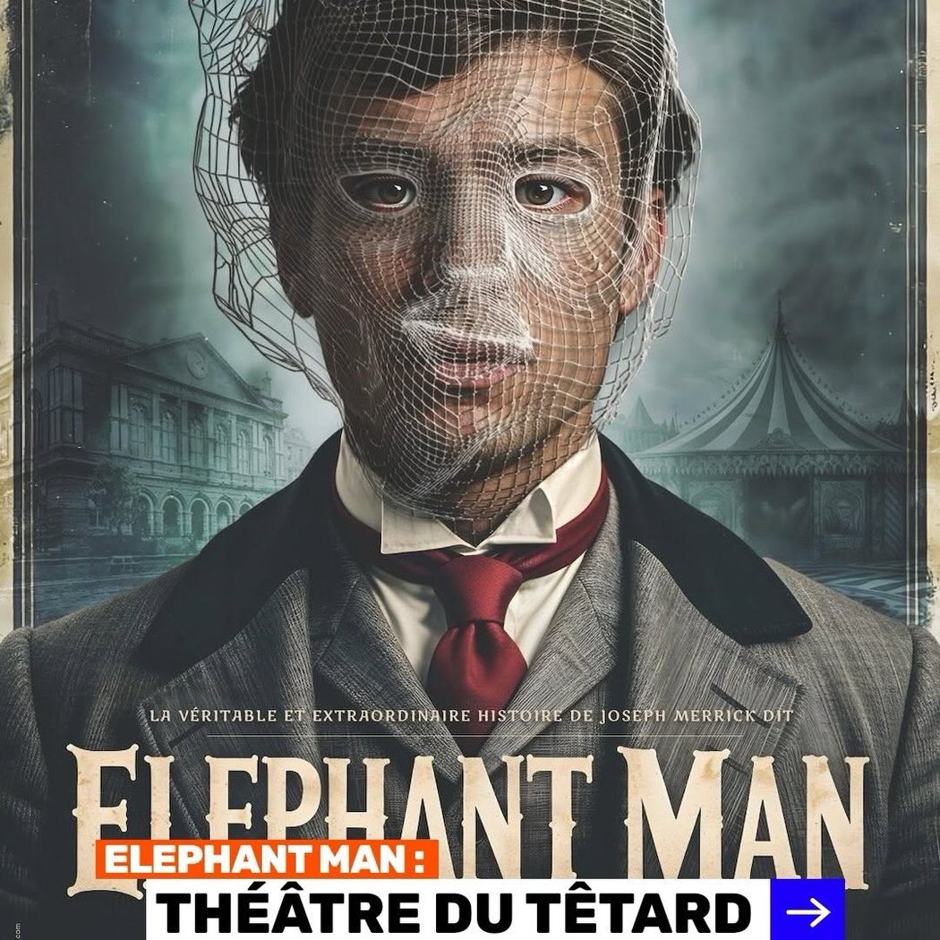 Elephant Man 1