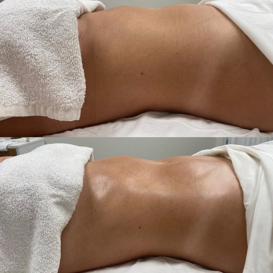 Massage Turbinada Roquebrune-sur-Argens Thierry Joos 2
