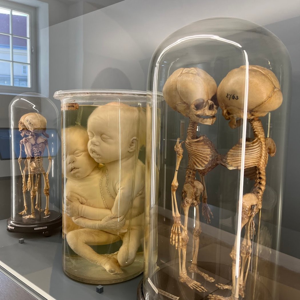 Pathological-anatomical collection in the Narrenturm 4
