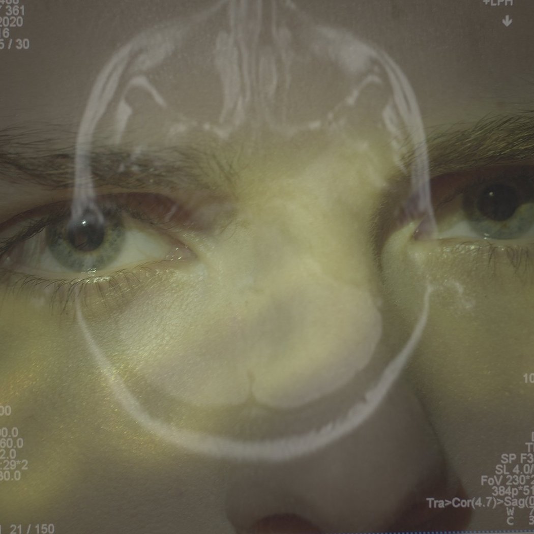 Screening & Conversation: When Honey Tastes Like Metal 1