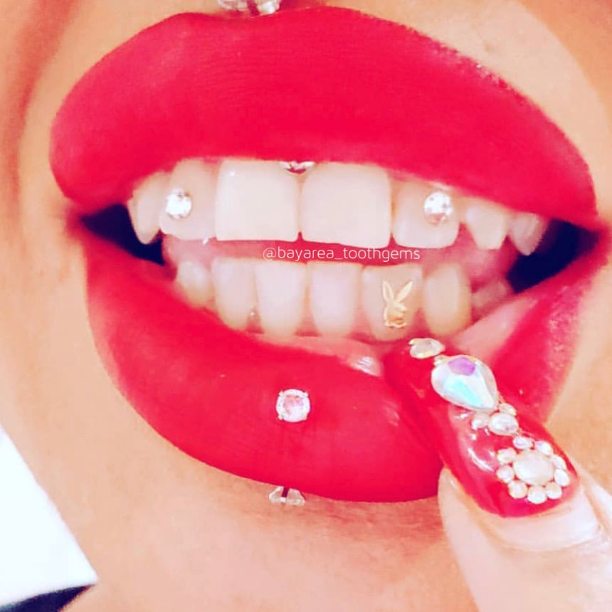 Bay Area Tooth Gems 1
