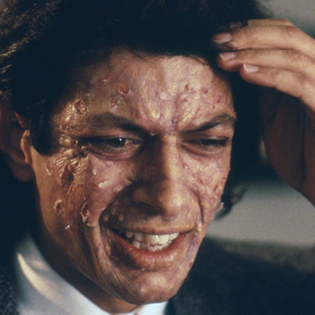 The Fly 1
