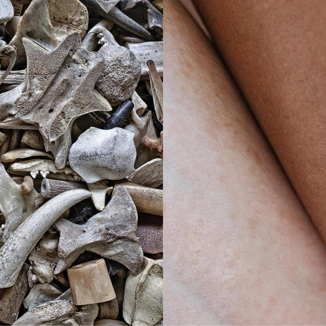Bone Archive, Skin Horizon 1