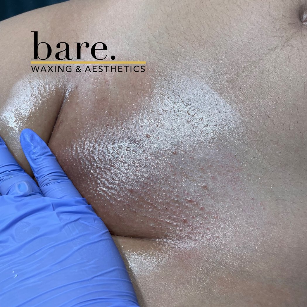 bare. Waxing & Aesthetics - Home of the 7 Minute Brazilian. Brow Artist. Bespoke Facials 3