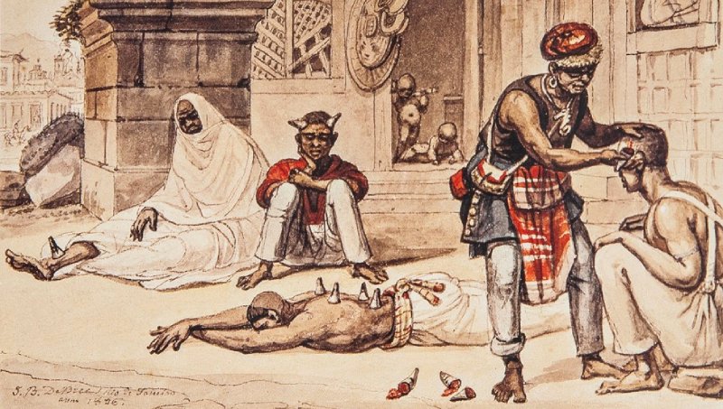 O Cirurgião Negro Colocando Ventosas, aquarela de Jean-Baptiste Debret, de 1826. A imagem mostra uma cena urbana do Brasil do século XIX com quatro pessoas negras em destaque. À esquerda, uma mulher está sentada no chão, coberta por um manto branco, com expressão adoentada. Ao seu lado, um homem de camisa vermelha e calça clara está sentado com os braços apoiados nos joelhos. No centro, outro homem negro, mais velho, usa turbante vermelho, colete escuro e um pano xadrez amarrado à cintura. Ele realiza um procedimento de cura com ventosas em um homem agachado, que está sem camisa. Objetos pequenos, como frascos e ventosas, estão espalhados no chão. Ao fundo, há construções de pedra e figuras que parecem crianças enfermas, sugerindo um cenário urbano. A cena retrata práticas de cura de matriz africana realizadas por curandeiros, saberes tradicionais que foram perseguidos pela medicina e pelas autoridades no Brasil do século XIX.