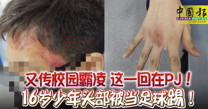 谈校园霸凌 :不要让校园成为暴力的温床,我们需要的是尊重和友爱! | 文字碌碌 谈校园霸凌 :不要让校园成为暴力的温床,我们需要的是尊重和友爱! | 文字碌碌