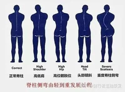左撇子在校园中面临的挑战:一种被忽视的少数群体? | 文字碌碌 左撇子在校园中面临的挑战:一种被忽视的少数群体? | 文字碌碌