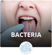 BACTERIA