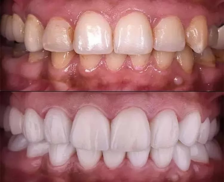 secure-checkout-denta-blast