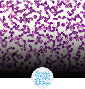 Limescale