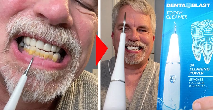 Denta vs others