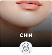 Chin
