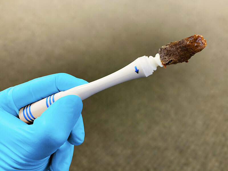 Earwax Remover