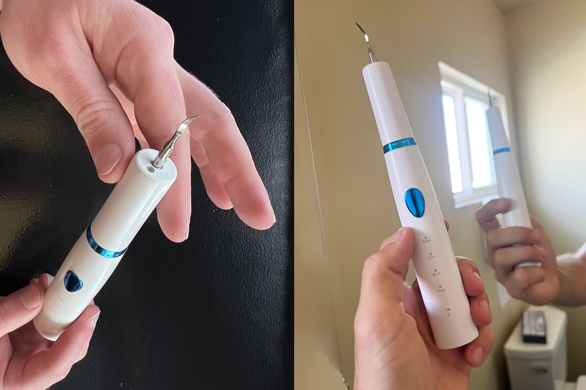 Denta Blast Before After