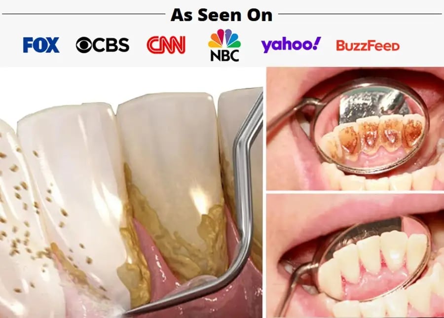 Denta vs others