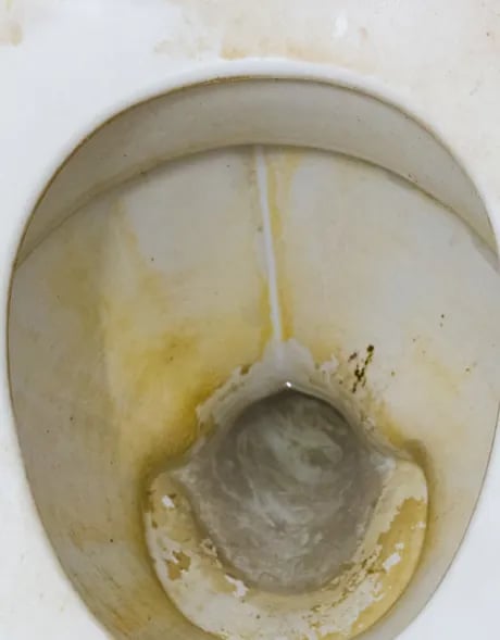 dirty toilet