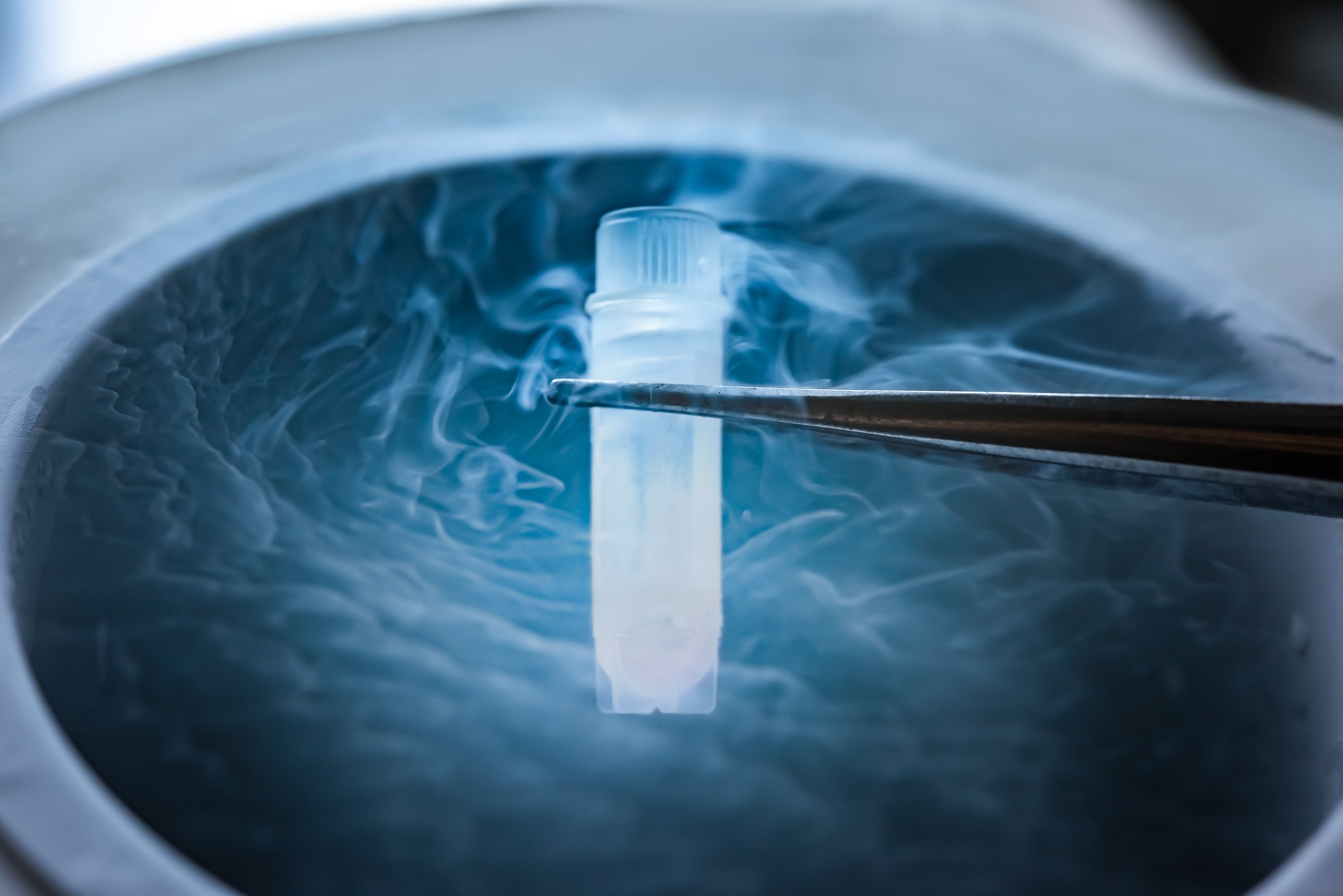 a plastic vial being held by a pair of medical lab tongues above a bath of cryogenic liquid which is smoking in a rippled pattern