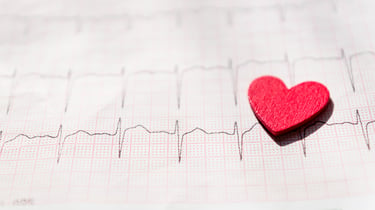 nuclear-stress-test-heartcare-texas