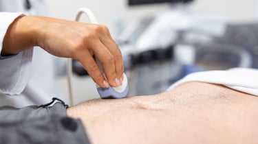 artery-doppler-ultrasound-heartcare-texas