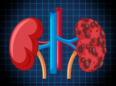 kidney-transplant-nephrology-consultants-pa