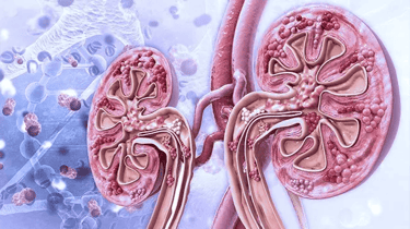 lupus-nephritis