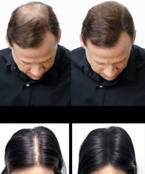 Product photo
