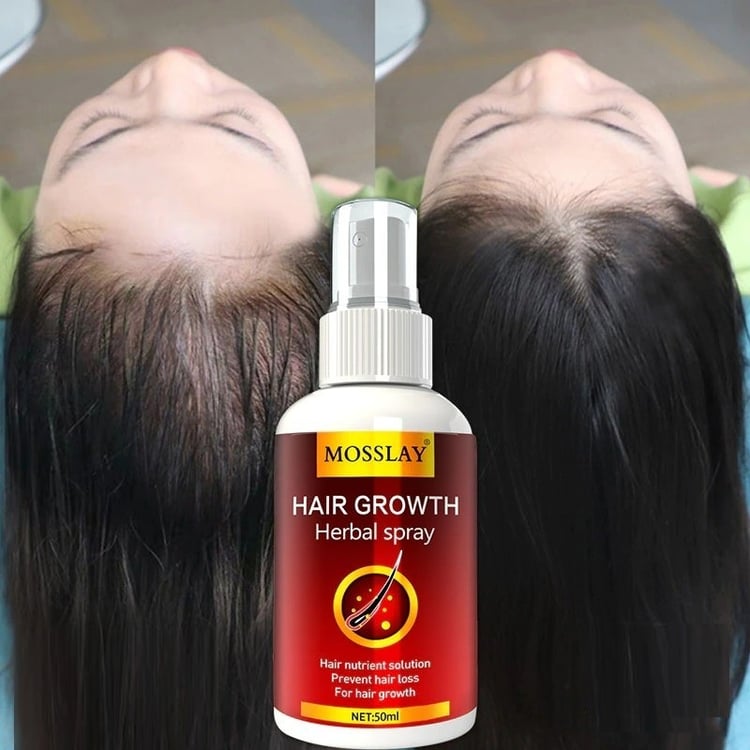 Productfoto