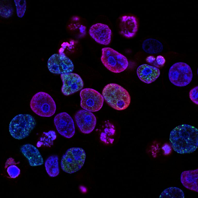 Oncoblast™-Bridging Science to Practice: Lung Cancer Management thumbnail