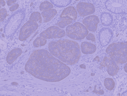 TopSideImage22-icon