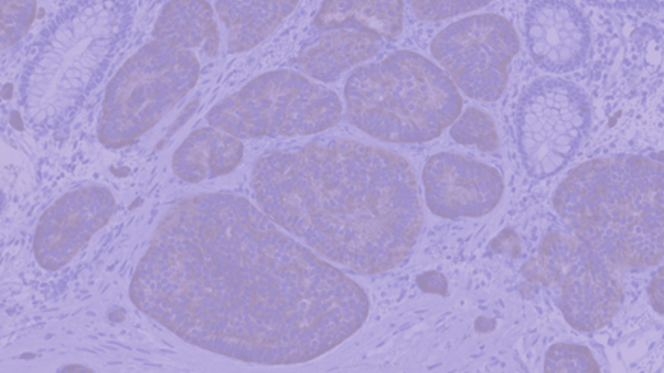 TopSideImage22-icon