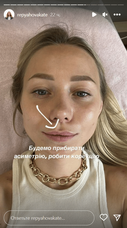 Stories Кати Репяховой