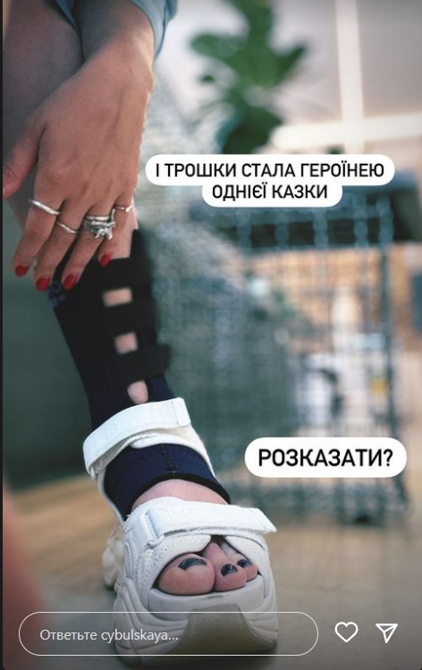 Оля Цибульська впала зі сходів та травмувалася - фото 1