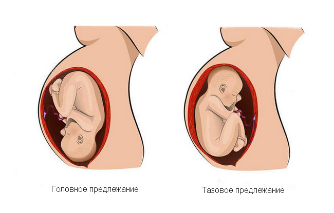 Роддом №1 Одесса, смерть младенца Одесса, смерть ребенка