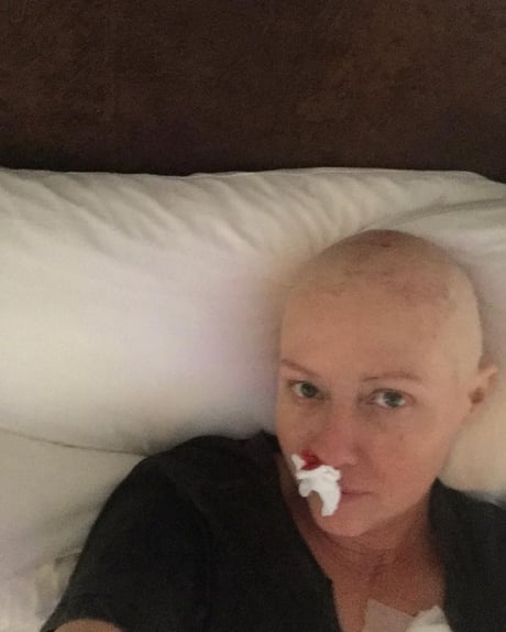 Шеннен Доэрти показала правдивые фото борьбы с раком