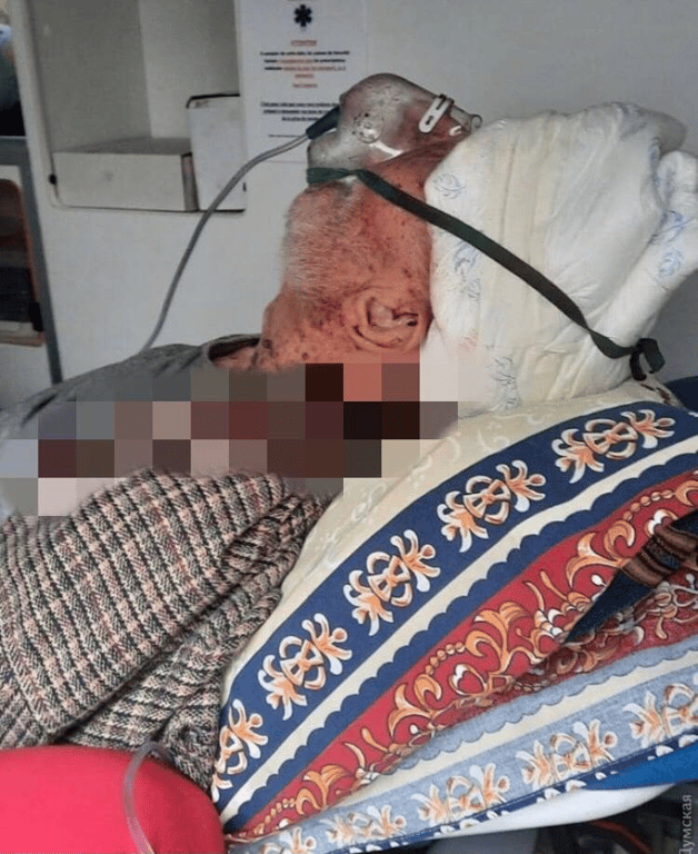В Одесі помер пенсіонер із COVID-19, якого виписали з травмою голови