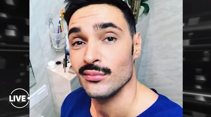 козловский пластика