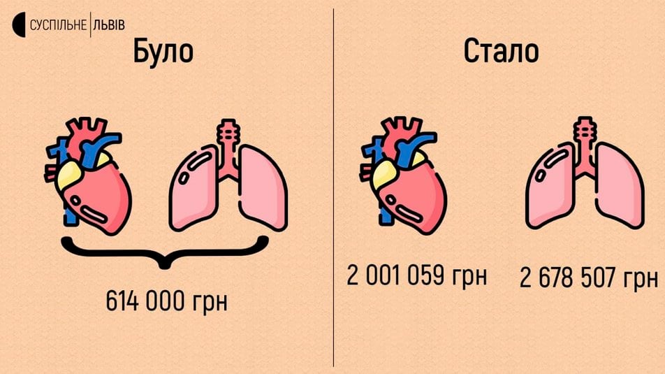 Трансплантація органів Львів