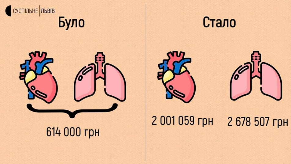 Трансплантація органів Львів