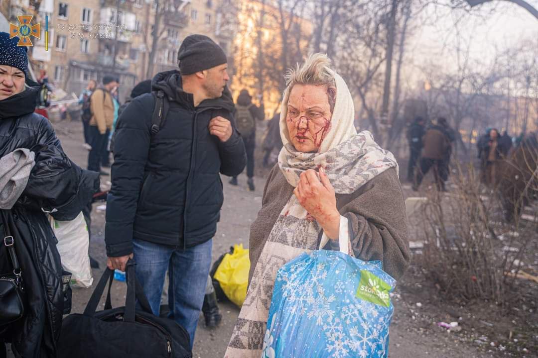 Обстріли