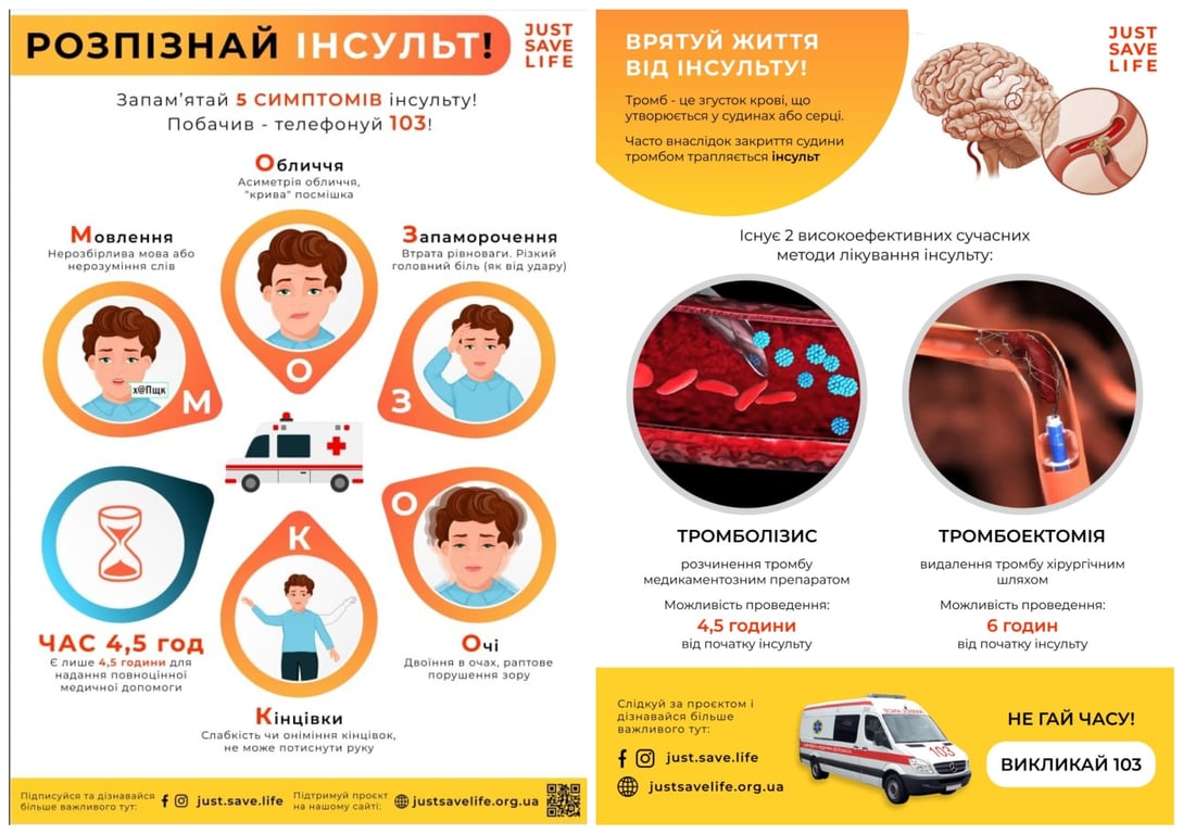 інсульт