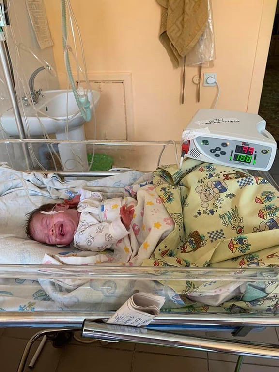 В Одесі лікарі врятували життя двох немовлят вагою менше кілограма