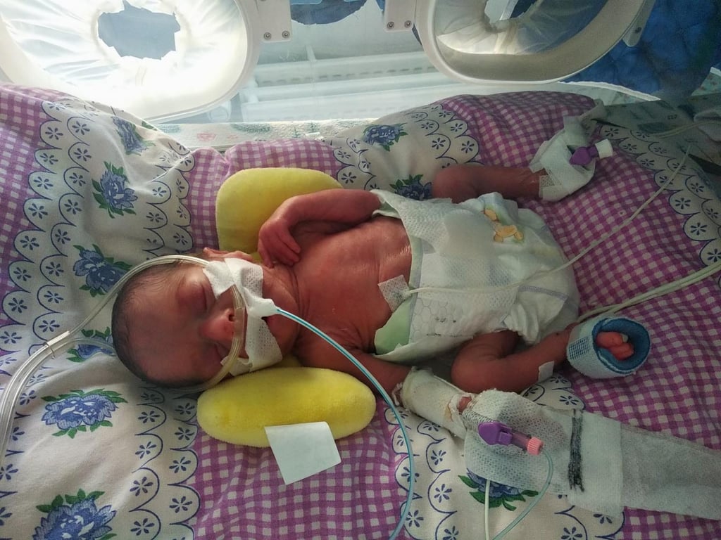 В Одессе врачи спасли жизнь двух младенцев весом меньше килограмма