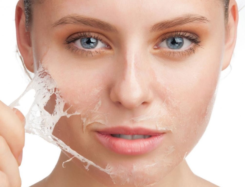 Как избавиться от сухости кожи лица зимой - регулярное увлажнение