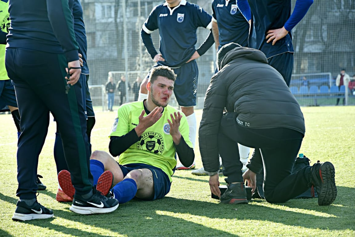 Александр Чернята повредил лицо в жестком столкновении