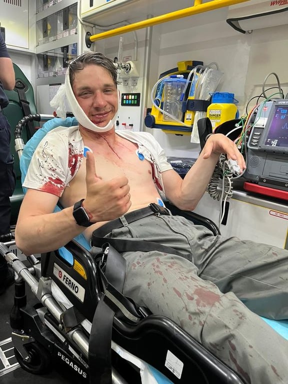 Українському актору в Дубліні порізали обличчя - фото 2