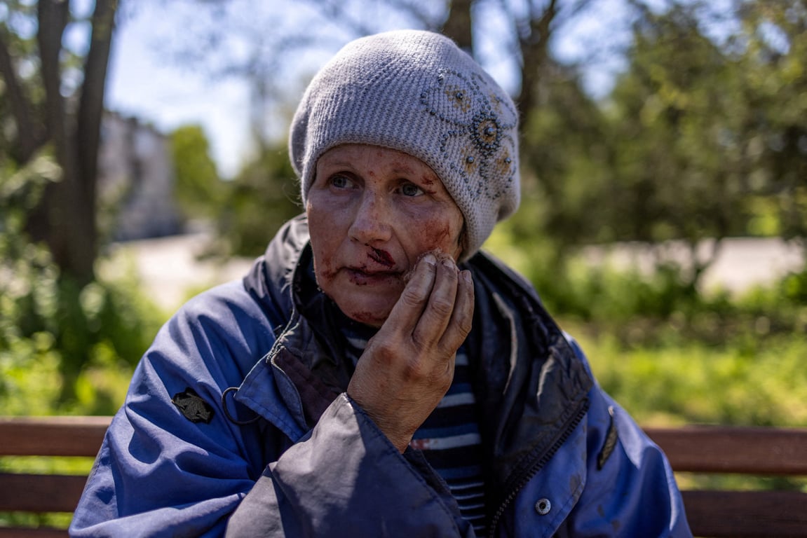 війна в Україні