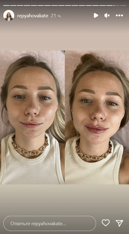 Stories Кати Репяховой